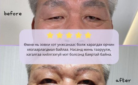 "Wonderful"  Гоо сайхны мэс заслын эмнэлэг  Before & After