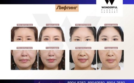 "Wonderful"  Гоо сайхны мэс заслын эмнэлэг  Before & After