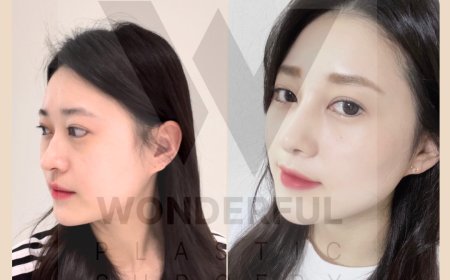 Wonderful гоо сайхны мэс заслын эмнэлэг   Before & After 