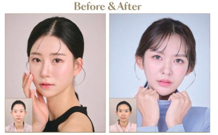 "Lienjang гоо сайхны мэс заслын эмнэлэг" Before & After 