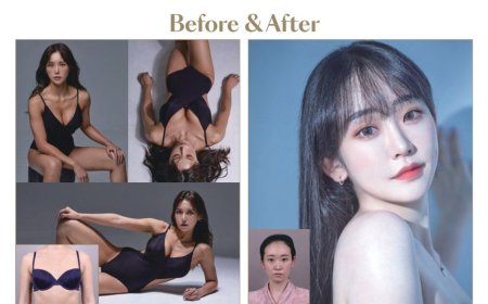 Хөхний мэс засал "Lienjang гоо сайхны мэс заслын эмнэлэг"  Before & After 