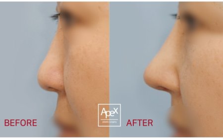 " Apex " Гоо сайхны мэс заслын эмнэлэг  Before & After 