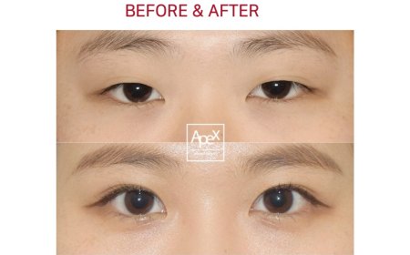 " Apex " Гоо сайхны мэс заслын эмнэлэг  Before & After 