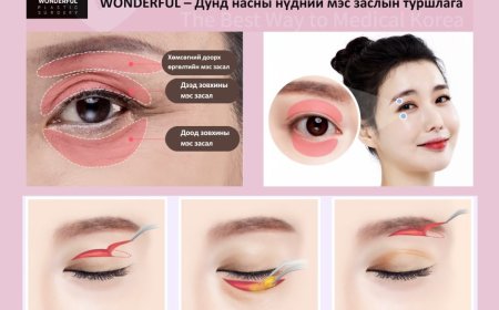 Wonderful Plastic Surgery – Дунд насны нүдний мэс заслын туршлага