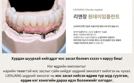 Нэг өдрийн имплант  "Lienjang шүдний эмнэлэг"