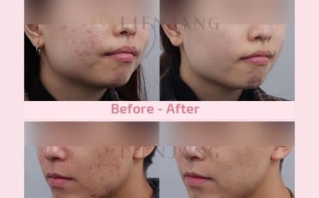 Батганы эмчилгээ , Lienjang арьсны эмнэлэг