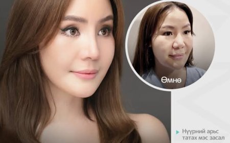 "Нана гоо сайхны мэс заслын эмнэлэг"   Before & After 