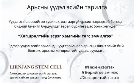 Арьсны үүдэл эсйин тарилга