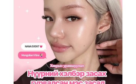 Mongolian V-line Нүүрний хэлбэр засах гурвалсан мэс засал