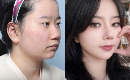 Мэс заслын дараах 😍