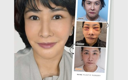 NANA залуужуулах мэс заслын 2 сарын дараах өөрчлөлт