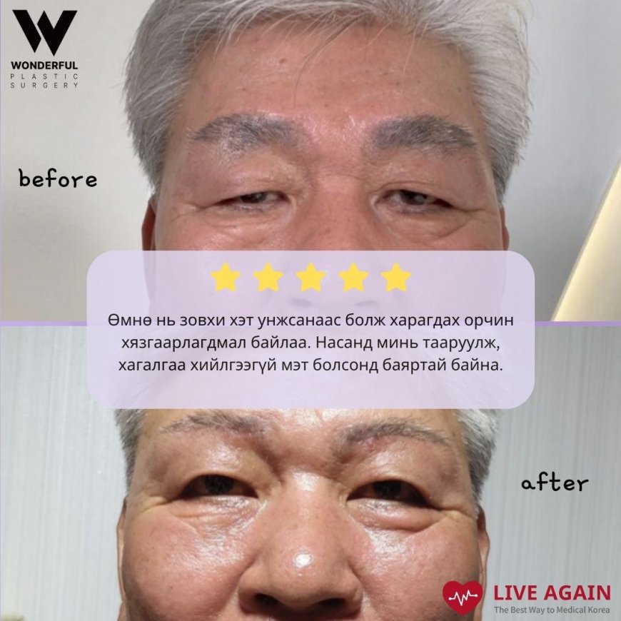 "Wonderful"  Гоо сайхны мэс заслын эмнэлэг  Before & After