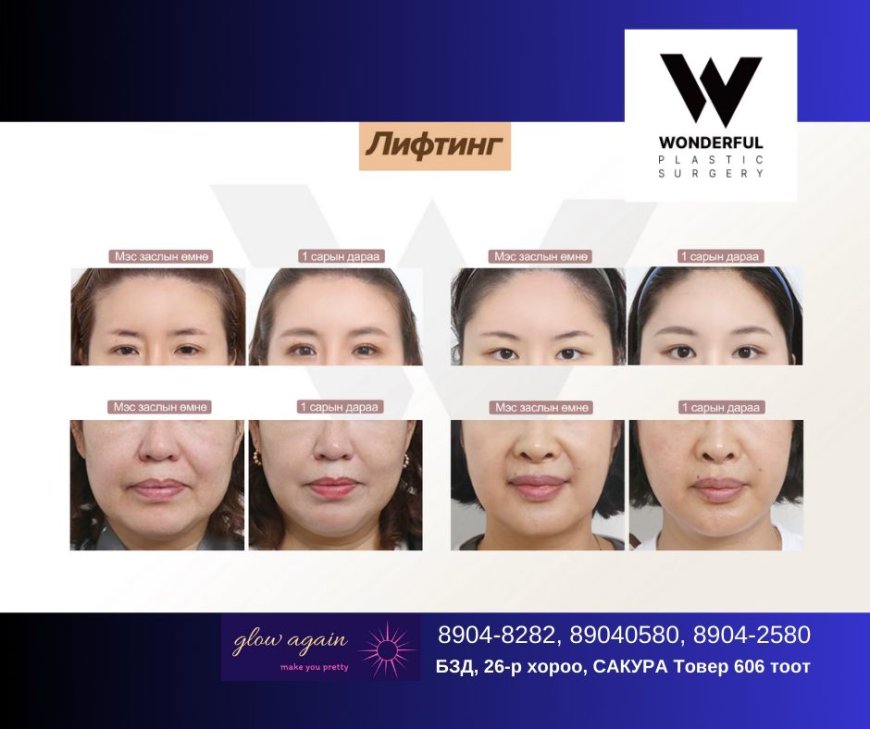 "Wonderful"  Гоо сайхны мэс заслын эмнэлэг  Before & After