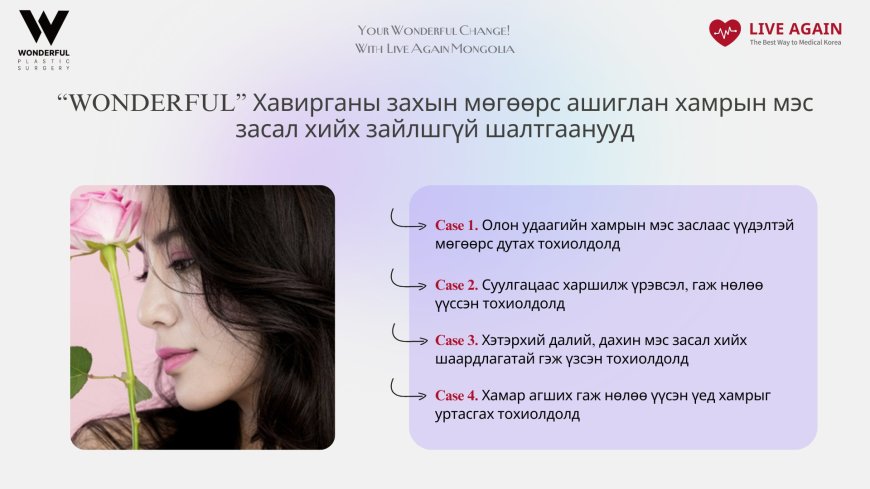 "Wonderful"  Гоо сайхны мэс заслын эмнэлэг   Хамрын мэс засал