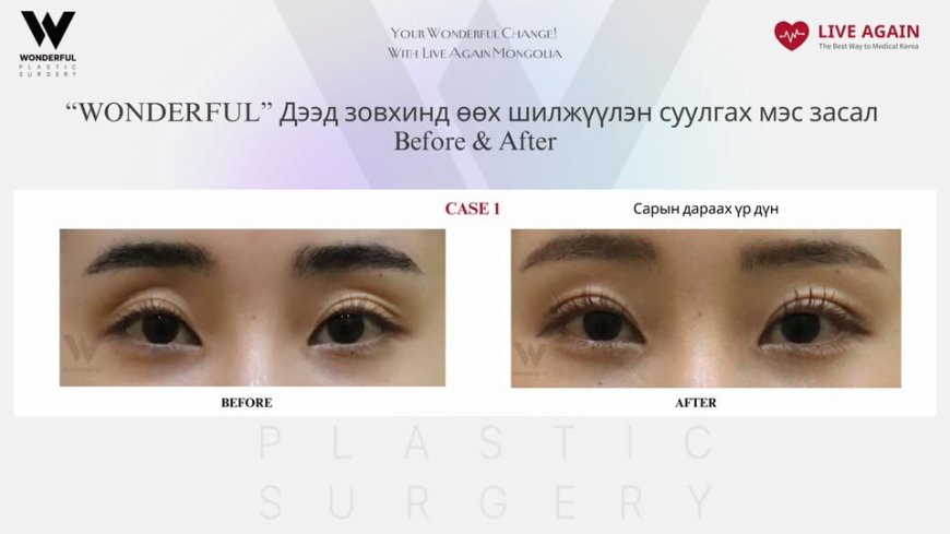 Your Wonderful Change! With Re Beauty Mongolia  "Wonderful"  Гоо сайхны мэс заслын эмнэлэг