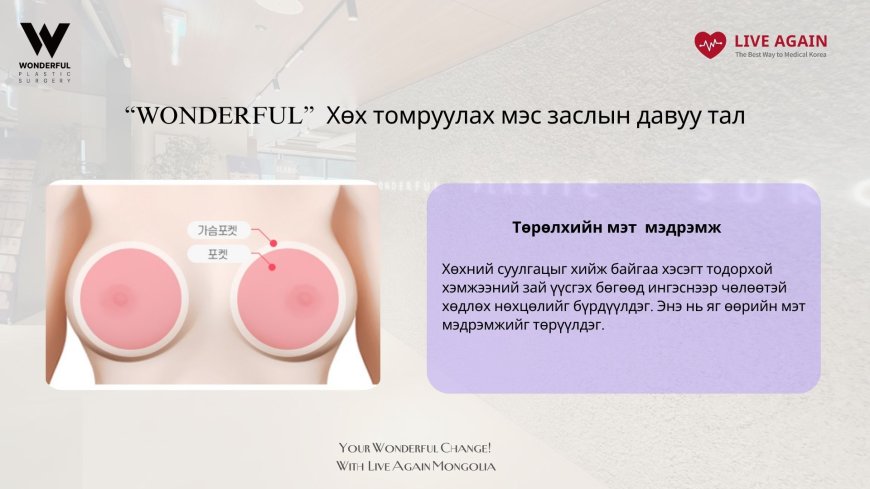 "Wonderful"  Гоо сайхны мэс заслын эмнэлэг "Хөх томруулах мэс засал"