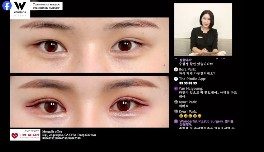 Давхраа хийлгэсний дараах үр дүн