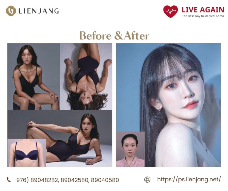 Хөхний мэс засал "Lienjang гоо сайхны мэс заслын эмнэлэг"  Before & After 