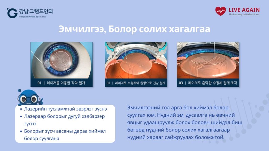 Болор солих хагалгаа "Гангнам Гранд нүдний эмнэлэг"