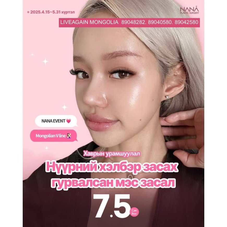 Mongolian V-line Нүүрний хэлбэр засах гурвалсан мэс засал