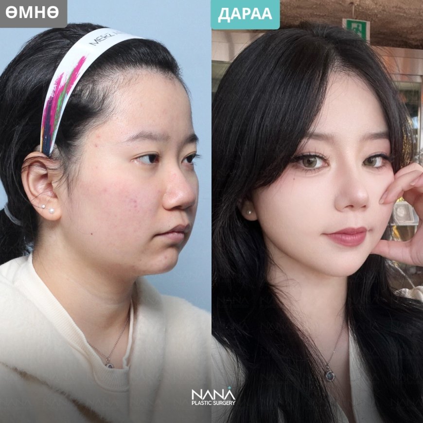 Мэс заслын дараах 😍