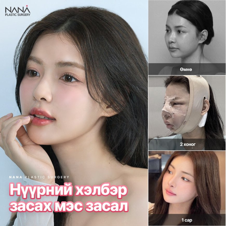 Нүүрний хэлбэр засах гурвалсан мэс засал