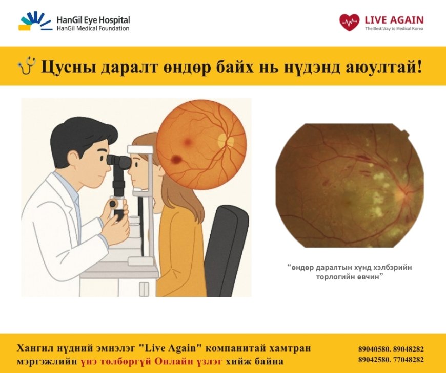 🩺 Цусны даралт өндөр байх нь нүдэнд аюултай! 👀