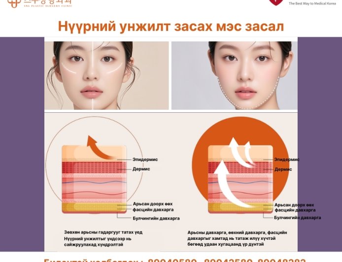 🧠 Нүүрний унжилт – Яагаад зөвхөн арьсыг татах нь хангалтгүй вэ?